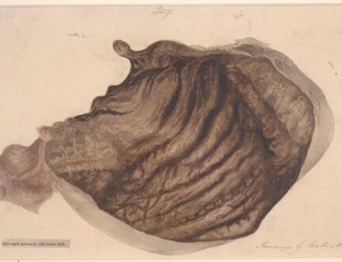 How to Find Out If You Need Extra Hydrochloric Acid